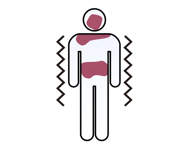 死後硬直イメージ