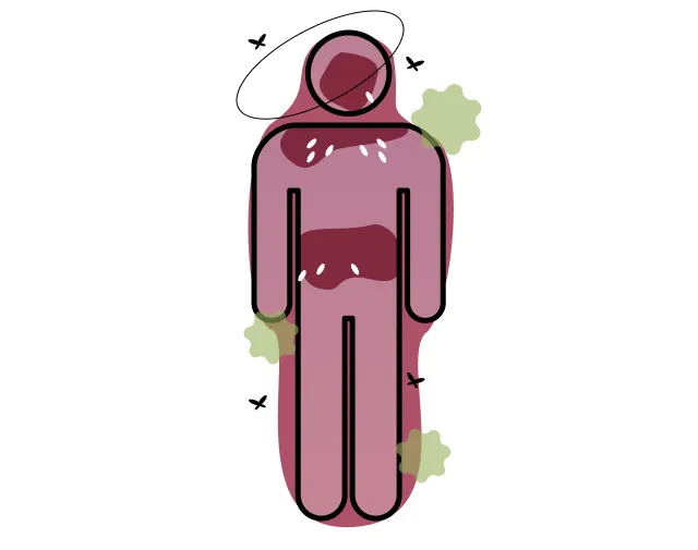 腐敗ガスイメージ